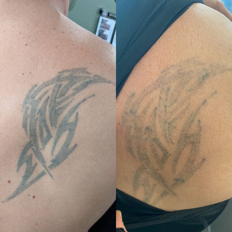 Laser`s work sample 1